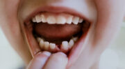 когда у детей выпадают молочные зубы, 5 простых способов облегчить боль